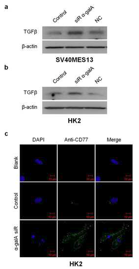 α-gal A siRNA가 도입된 SV40 MES 13 와 HK2 cell line에서 TGF-β의 발현(a, b)과 Gb3 (CD77, c)의 발현을 확인함.