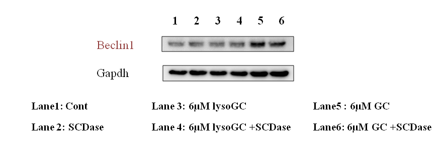 Glucocrebroside와 glucosylsphingosine에 의한 H4 cell에서의 Beclin-1의 발현을 확인함.