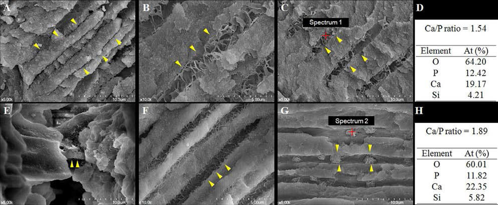 Representative scanning electron microscope images of gutta-percha with pozzolan-based (Pz-) MTA sealer cement- (A-D) or ProRoot MTA- (E–H) filled roots with phosphate buffered saline pretreatment