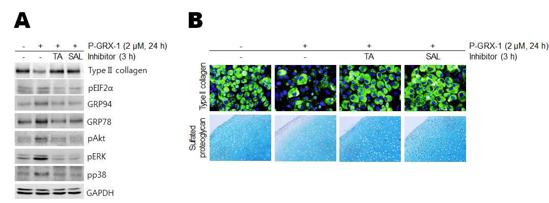 P-Grx-1에 의한 탈분화가 소포체 스트레스에 의한 것인지 확인하기 위하여 소포체 스트레스의 저해제인 Salubrinal (SAL)과 Tauroursodeoxycholic acid (TUDCA)를 처리하여 type II collagen의발현및 sulfated proteoglycan의 합성량을 확인 함.