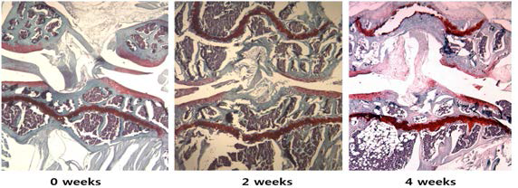 collagenase를 무릎 관절강에 투여후 연골조직 손상 정도의 평가