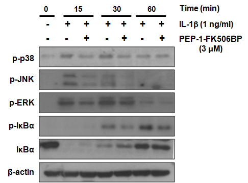 PEP-1-FK506BP의 연골세포에서 IL-1β가 유도하는 MAPK와 NF-kB 신호체계에 대한 영향