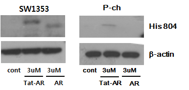Tat-AR와 AR 단백질의 SW1353 세포와 사람 연골세포로의 전달 확인