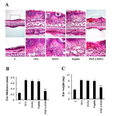 PEP-1 PON1 단백질의 동물 귀 부종 모델에서의 조직 보호 효과