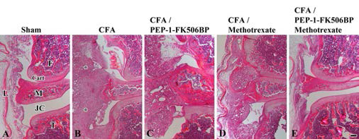 관절 침투성 FK506BP 융합단백질 주사제 관절염 효능 평가. H&E 염색