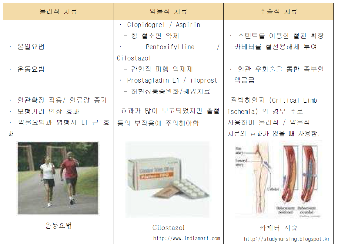 말초동맥질환의 일반적인 치료법