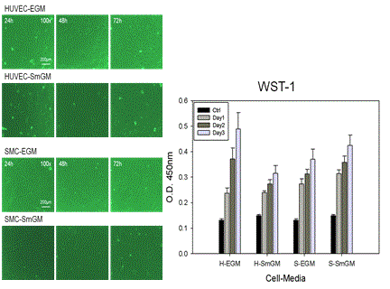 EGM, SmGM에서 배양한 혈관내피세포와 근육세포의 형태 및 두 가지 배지에 대한 혈관내피세포와 근육세포의 세포 활성