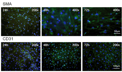 시간에 따른 근육세포와 혈관내피세포의 ECM 구조