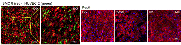 Transfer 후 세포시트의 ECM(F-actin) 구조와 근육세포, 혈관내피세포의 분포