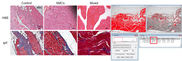 염증 반응을 알아보기 위한 H&E staining과 fibrosis를 알아보기 위한 MT staining 및 Fibrosis 정량 방법