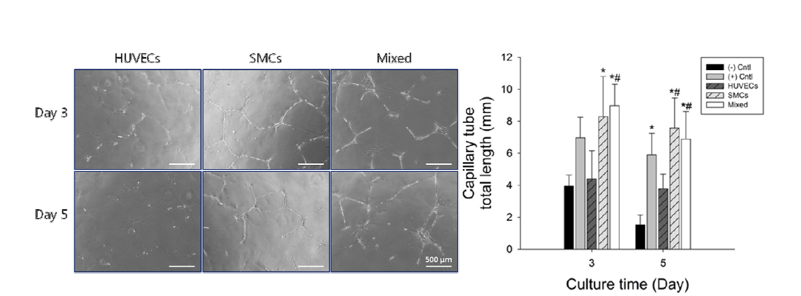 Growth factor reduced matrigel 위에 형성된 혈관내피세포의 tubule 형태 및 형성된 tube의 total length