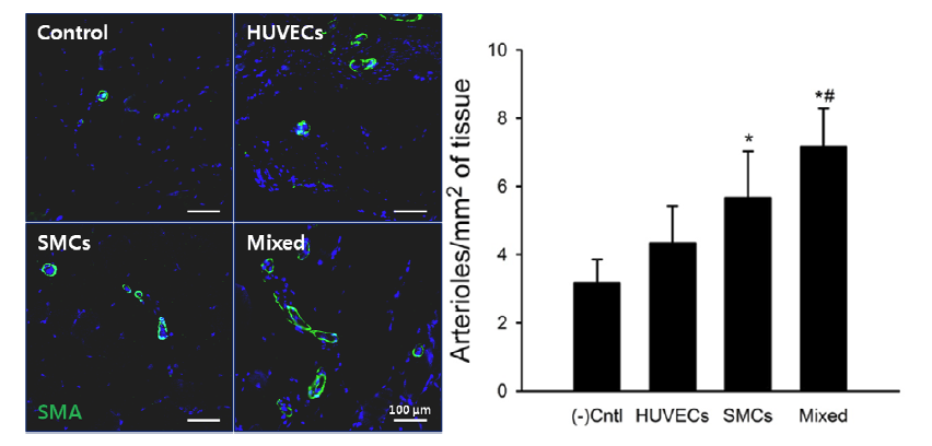 SMA 면역염색을 통한 소동맥 재생 정도 평가