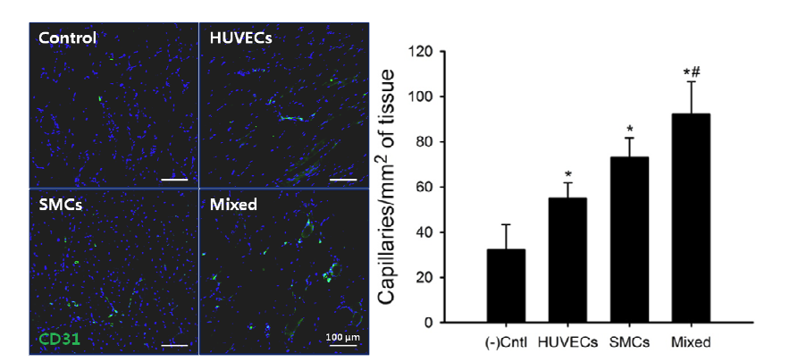 CD31 면역염색을 통한 모세혈관 재생 정도 평가