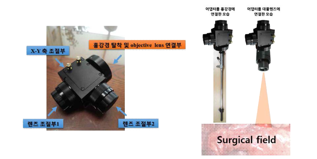 흉강경과 개흉 복합 광학 시스템의 연동이 가능한 어댑터 모듈의 모습