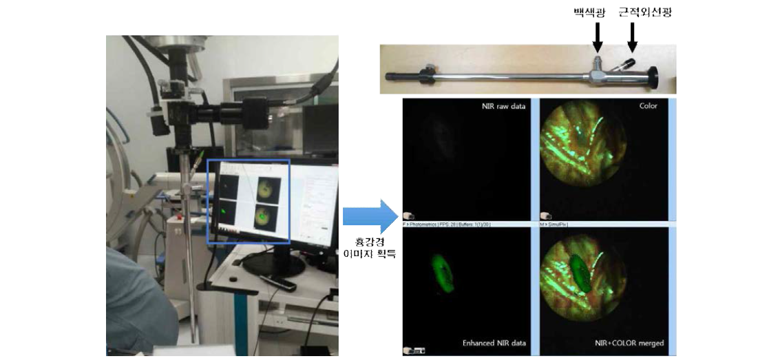 복합 근적외선 및 백색광 전달 흉강경 시스템의 사용 모습 및 획득 이미지