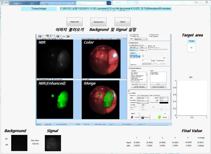 Matlab 기반 형광 영상 데이터 처리 프로그램 개발