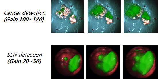 암 검출 및 감시림프절 검출 영상에서의 Gain 값 변동에 따른 이미지 차이