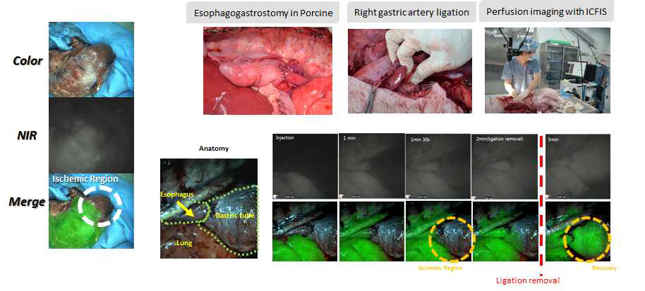 ICG를 이용한 돼지 식도위절제술