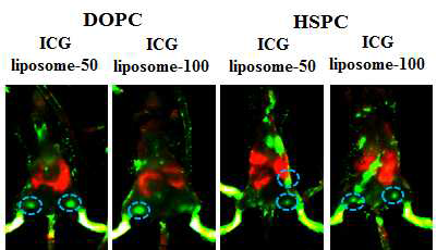 감시림프절탐색을 취한 liposome 물질 최적화