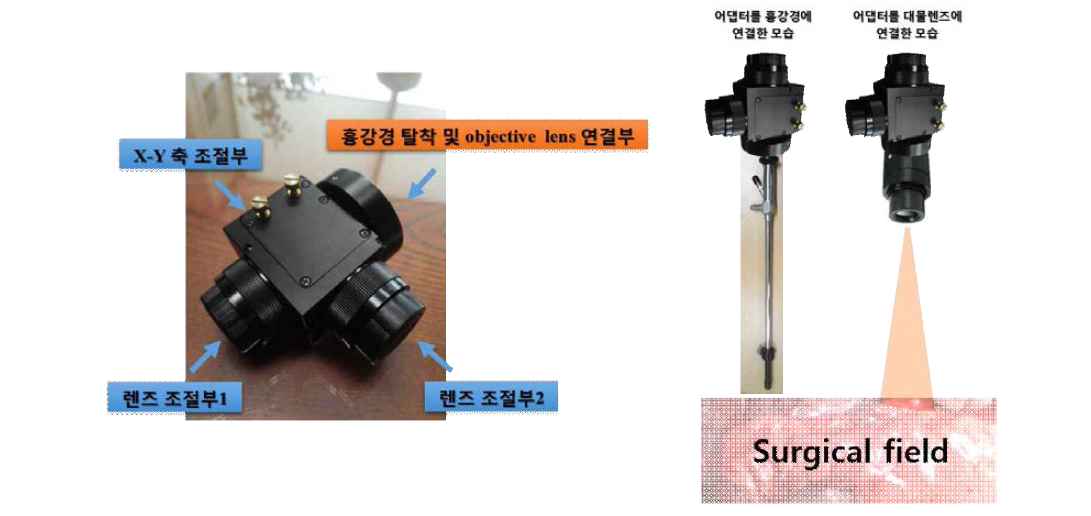 흉강경과 개흉 복합 광학 시스템의 연동이 가능한 어댑터 모듈의 모습