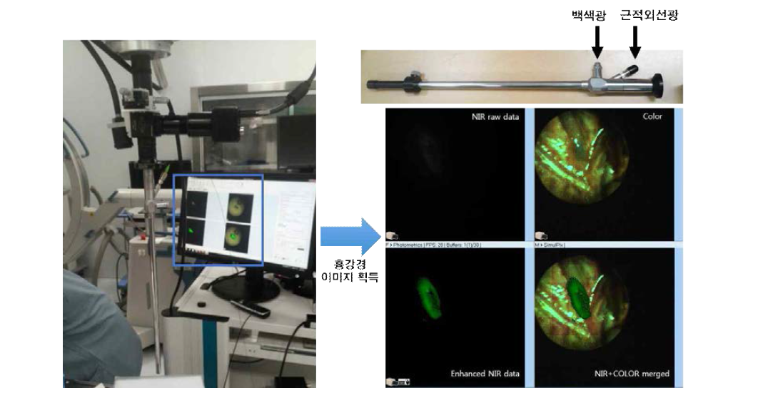 복합 근적외선 및 백색광 전달 흉강경 시스템의 사용 모습 및 획득 이미지