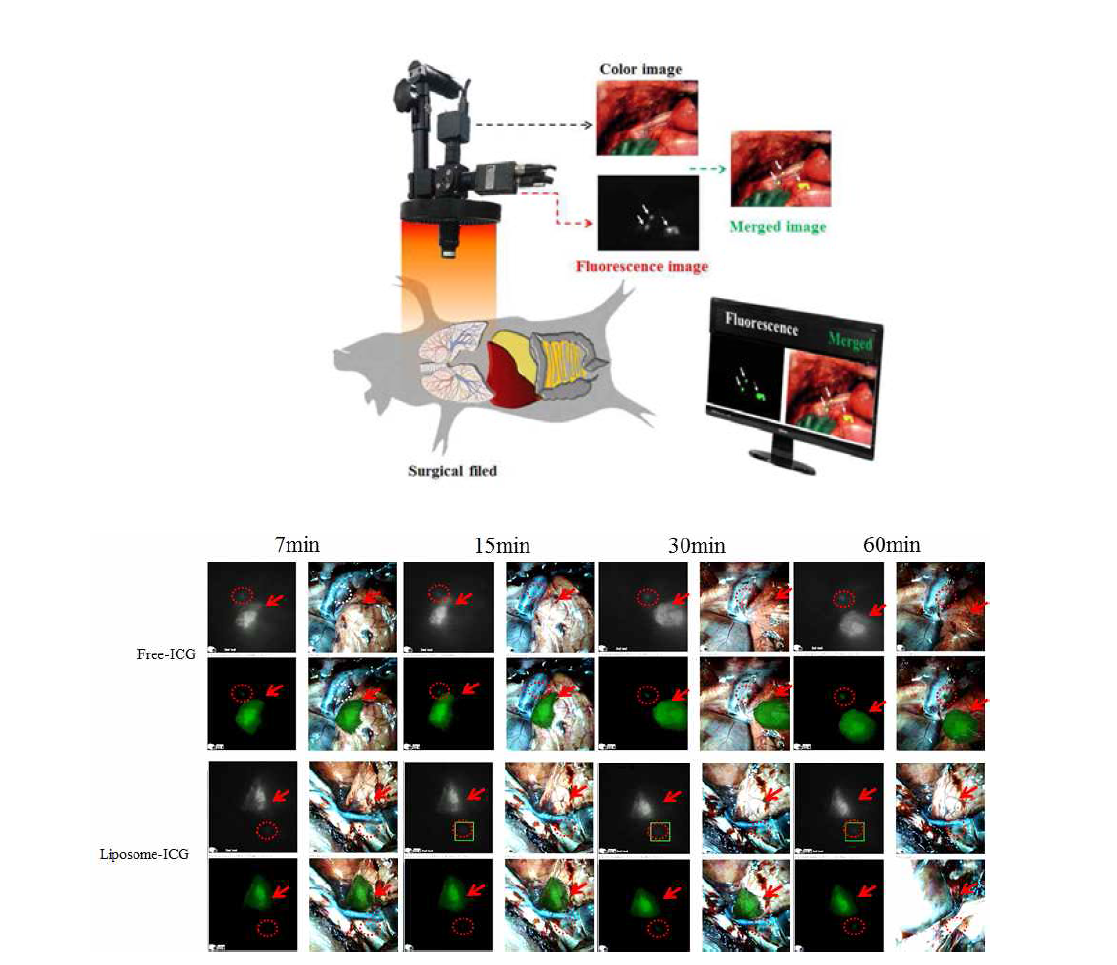 돼지 폐에서 ICG와 liposomal ICG의 감시림프절 탐색능 비교 및 평가