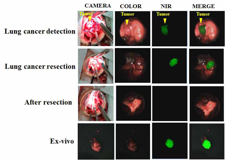 흉강경을 이용한 토끼 폐암의 ICG 형광영상