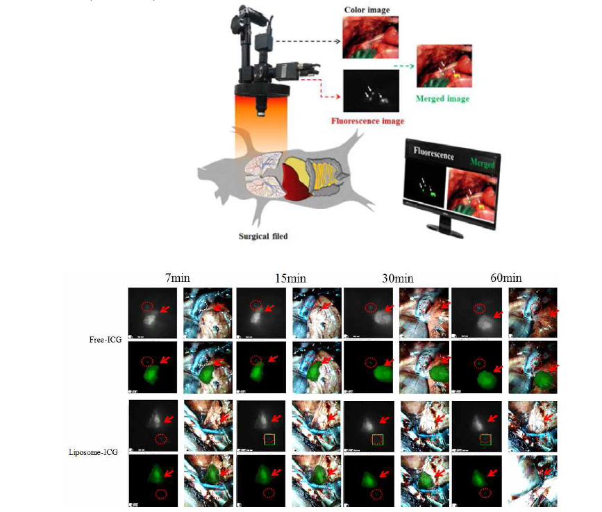 돼지 폐에서 ICG와 liposomal ICG의 감시림프절 탐색능 비교 및 평가