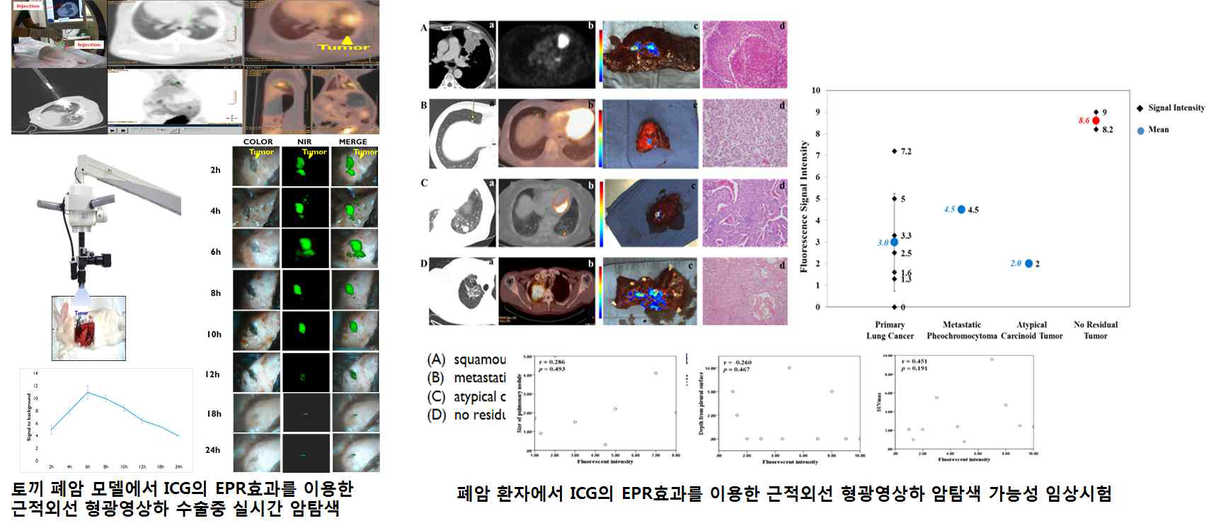 폐암 환자에서 ICG의 EPR효과를 이용한 근적외선 형광영상하 암탐색 가능성 임상시험