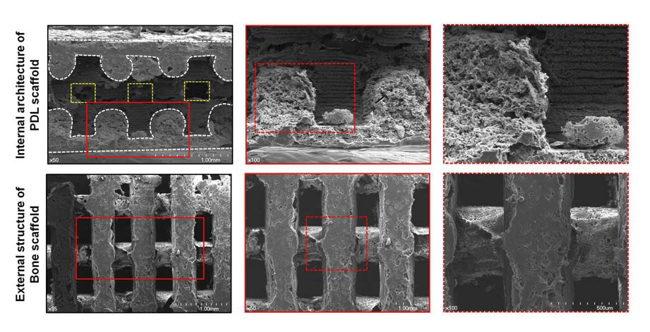 전자 주사 현미경 (SEM)을 통해 PCL scaffold의 PDL 구역 내부와 외부의 골 조직 형성 구역의 표면 분석