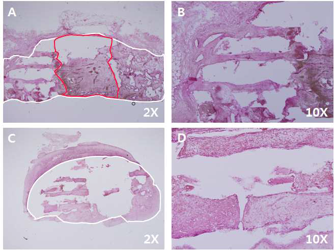이식 2주 후 scaffold 주변 조직반응(종단면).