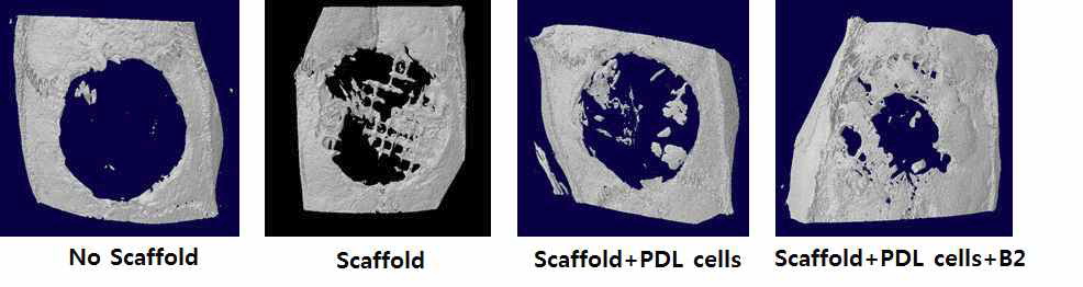 백서 두경부 손상부에 scaffold를 이식한 후 4주 후에 micro-CT 이미지