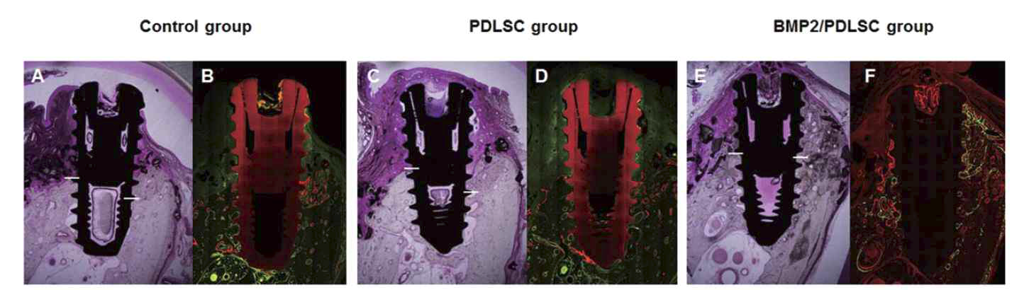 성견 임플란트 주위염 모델에서 손상된 부위에 생체활성인자를 이식한 후 12후에 관찰된 조직들