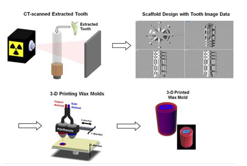 발치된 치아를 CT로 촬영한 뒤, 영상 자료를 바탕으로 CAD에서 scaffold를 설계. 이를 3-D 프린터로 wax mold를 제작