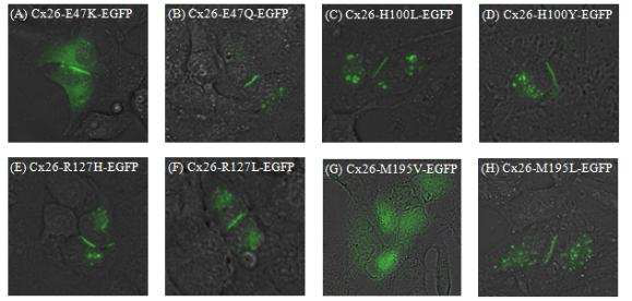 세포 내 Cx26 변이들의 발현양상