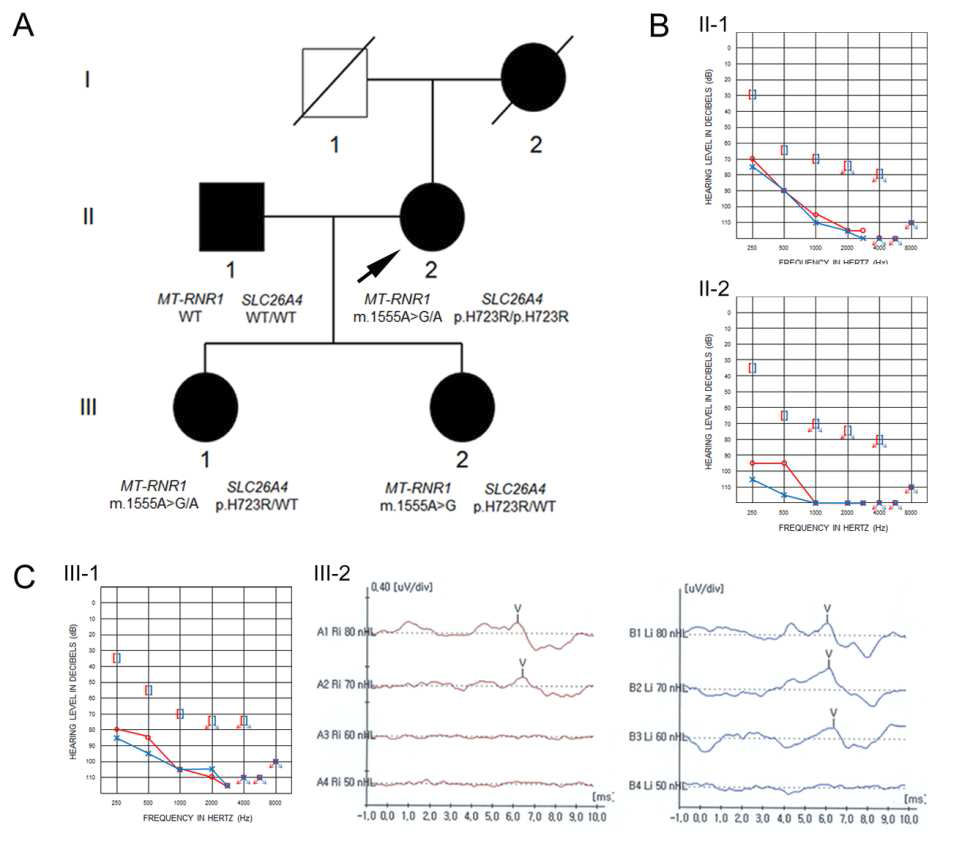 유전성 난청을 보이는 환자의 가계도와 가계구성원들의 청력도