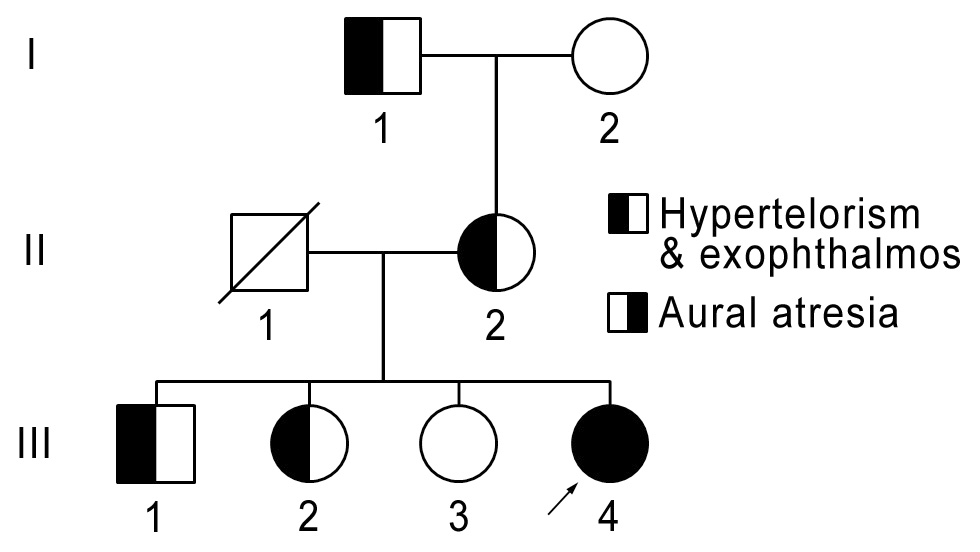 Crouzon 증후군을 보이는 환자의 가계도
