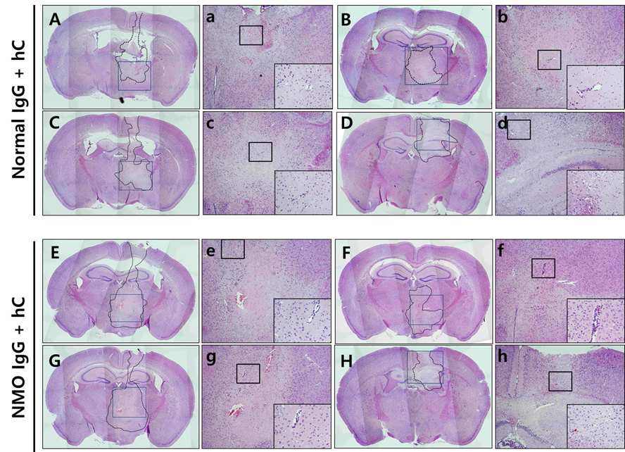 Intra-cerebral injection 24시간 후의 H&E염색