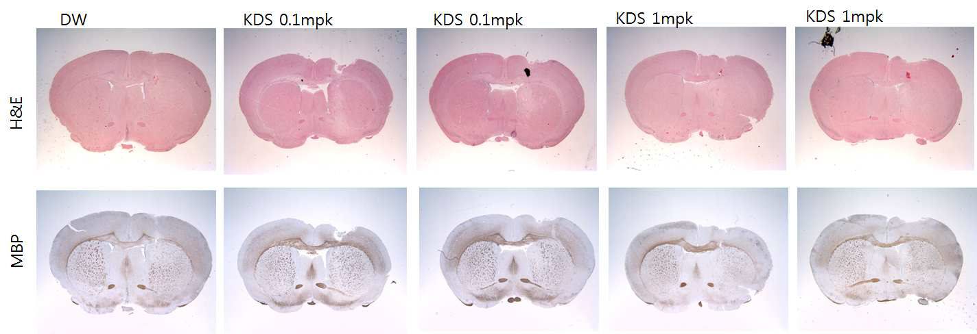 NMO-IgG와 AQP4와의 결합 억제 후보물질 (KDS)에 의한 NMO 병변의 염증 완화 및 myelin 소실의 감소