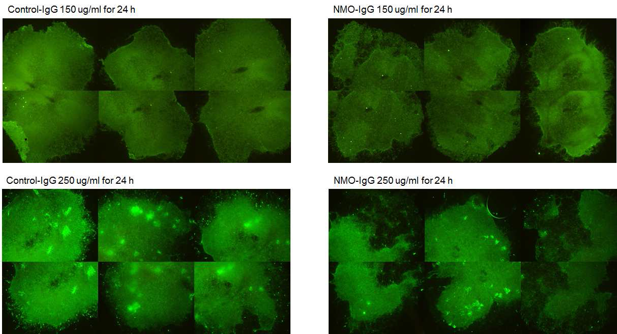 NMO ex vivo model에서 NMO-IgG 단독처리에 의한 신경세포의 사멸 가능성 확인