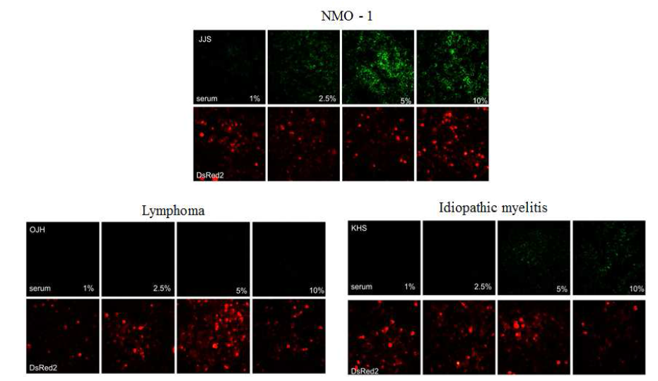 NMO 환자의 plasma와 AQP4를 과발현하는 U87MG cell line과의 dose dependent한 binding response