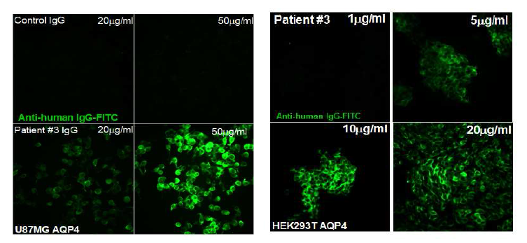 NMO-IgG의 dose dependent하게 증가하는 AQP4 과발현 cell line과의 binding response