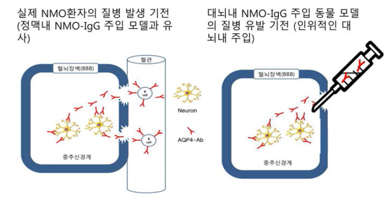 실제 NMO환자의 질병 발생기전과 대뇌내 NMO-IgG주입 모델의 질병 유발기전 모식도