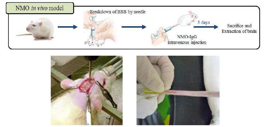 정맥 내 NMO-IgG 주입 모델의 모식도 (위) 및 주사 바늘로 혈뇌장벽을 자극 (아래, 좌)과 intravenous injection (아래, 우)