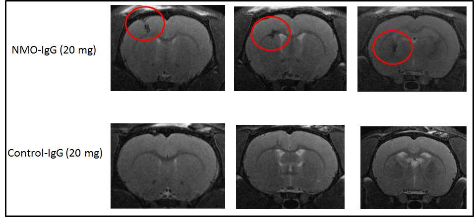 NMO in vivo model에서 NMO 병변의 MRI 영상을 통한 확인