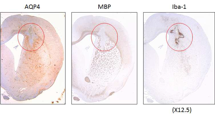Rat 정맥 내 NMO-IgG 주입 모델에서 brain injury 주변 부위의 AQP4, MBP의 발현 감소와 Iba-1의 발현 증가