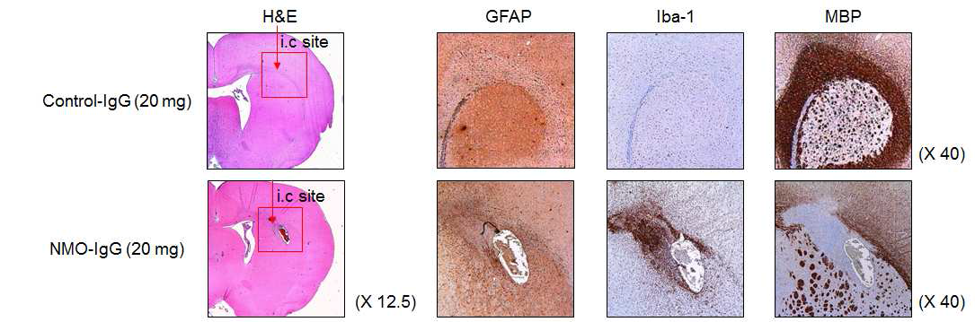 Rat 정맥 내 NMO-IgG 주입 모델에서 Control-IgG와 NMO-IgG를 주입한 경우 보이는 주입 주변 부위의 GFAP, Iba-1, MBP 발현의 차이