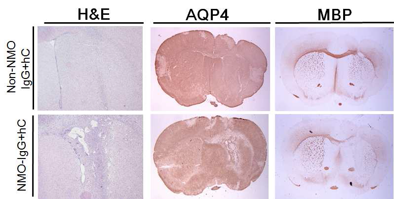 NMO 환자의 IgG와 hC를 주사한 동물의 조직을 주사하지 않은 반대쪽과 비교하였을 때, 현저한 염증세포의 침윤, AQP4 및 myelin의 감소가 관찰됨