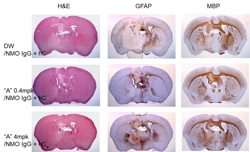 후보물질투여에 의해 염증세포의 침윤, GFAP 및 MBP의 감소가 억제됨이 관찰