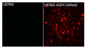 AQP4(M23)을 stable하게 과발현하는 U87MG 세포주 확립